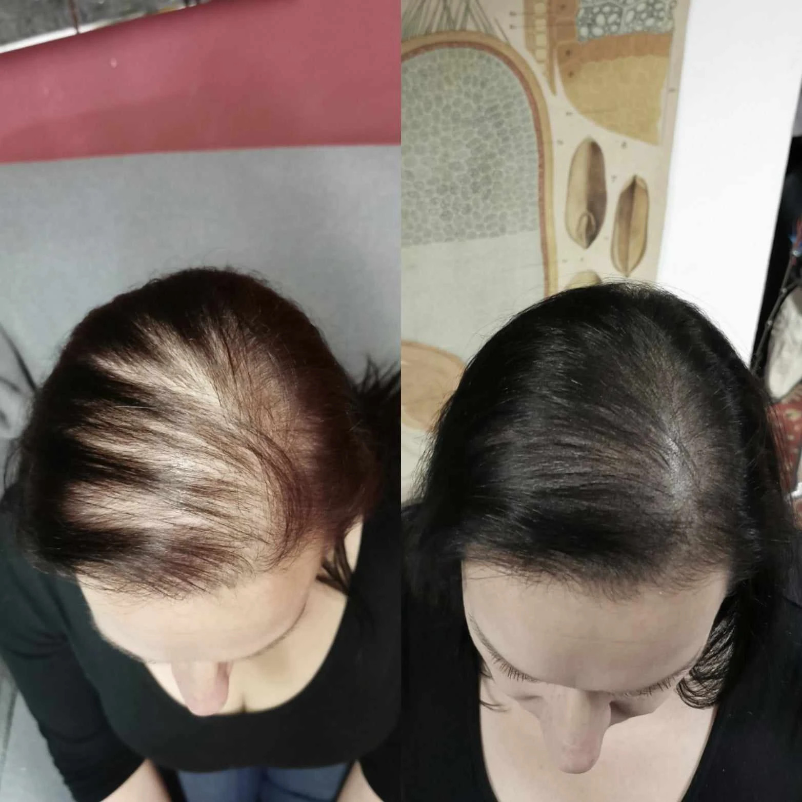 OPTISCHE HAARVERDICHTUNG BEI FRAUEN