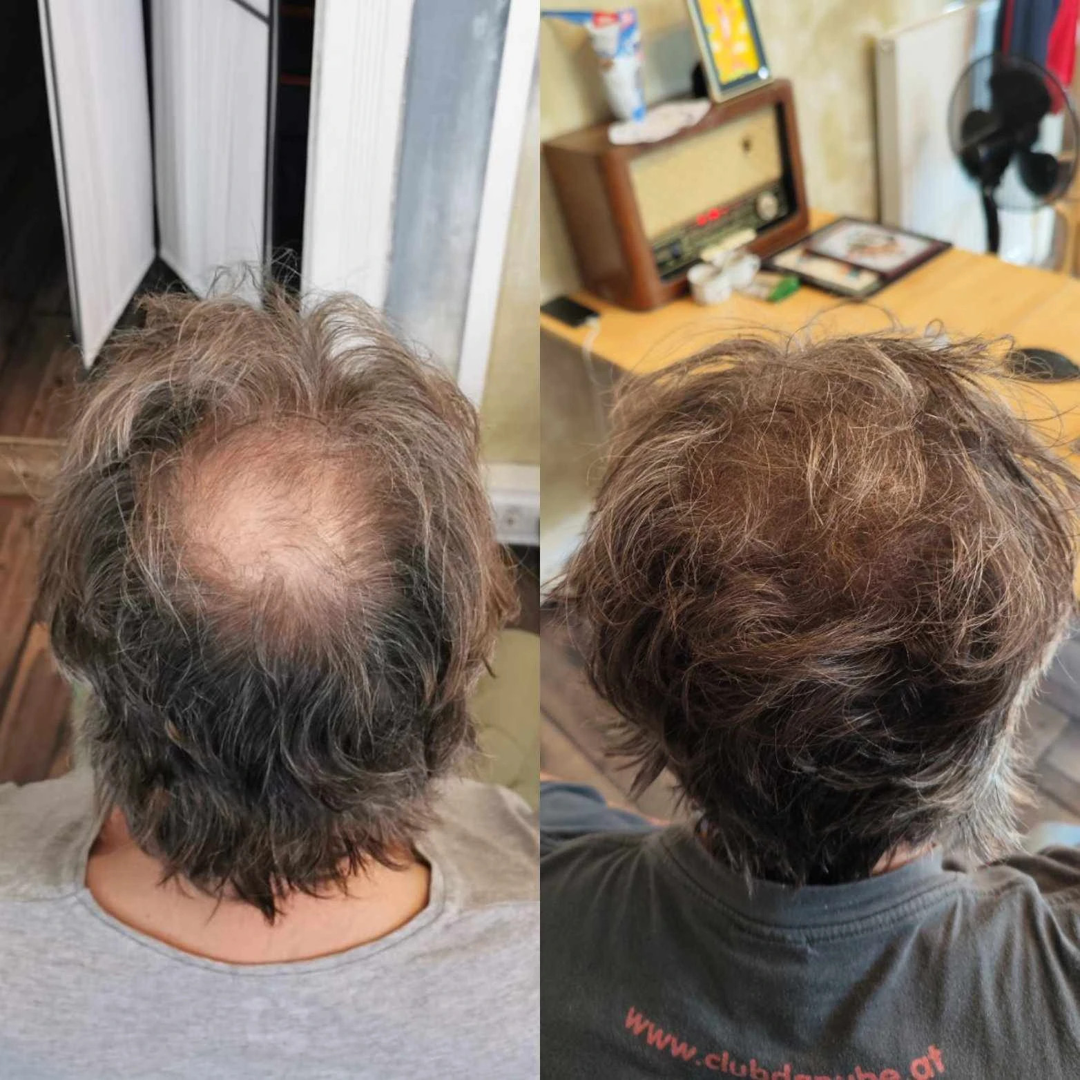 OPTISCHE HAARVERDICHTUNG BEI LANGEN HAAREN